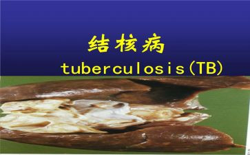 结核病工作半年总结5篇